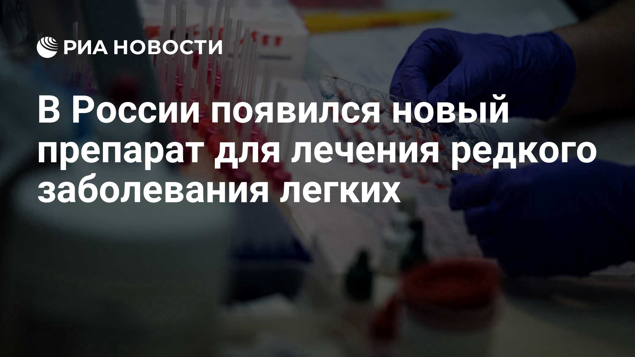 В России появился новый препарат для лечения редкого заболевания легких