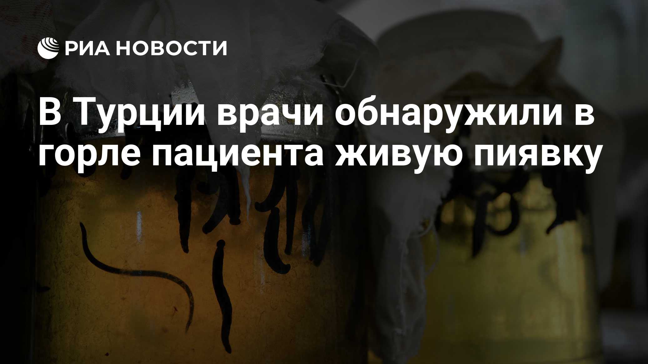 В Турции врачи обнаружили в горле пациента живую пиявку